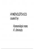 Parasitology - Hymenolepiasis