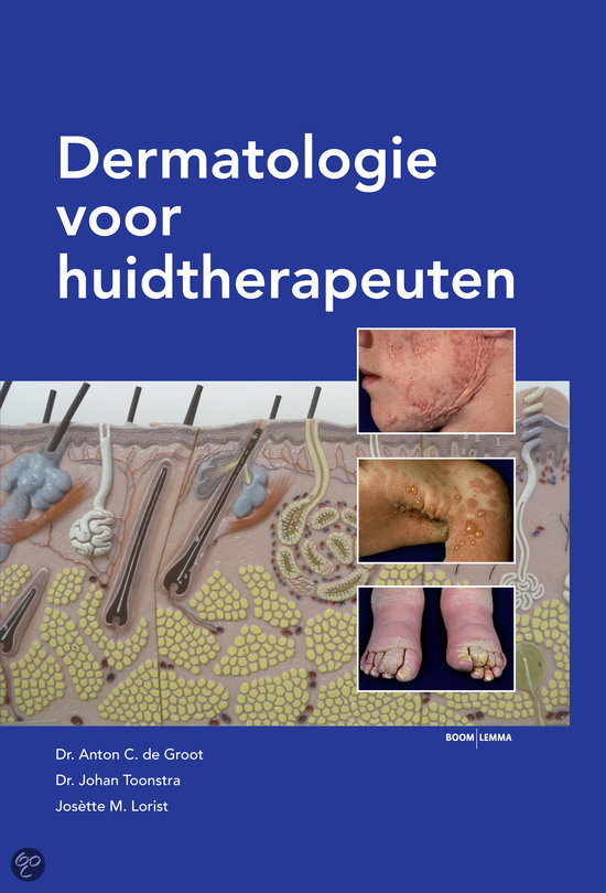 Dermatologie voor huidtherapeuten: acne, op acne gelijkende dermatosen, huidafwijkingen & infecties 
